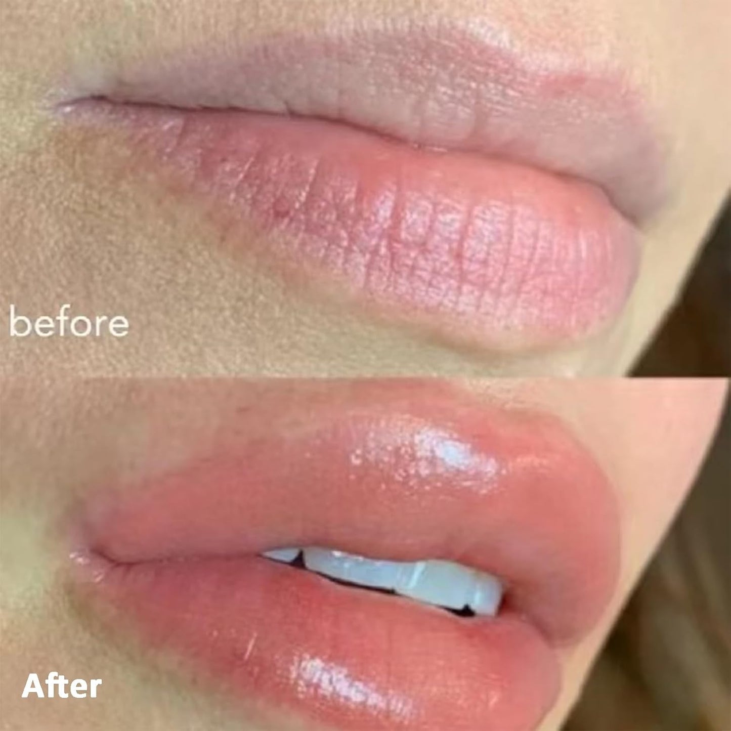 Volumizing Lip Plumper
