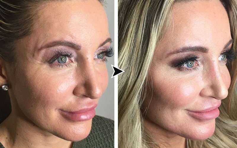 Instant Anti-Wrinkle Eye Tightener cream