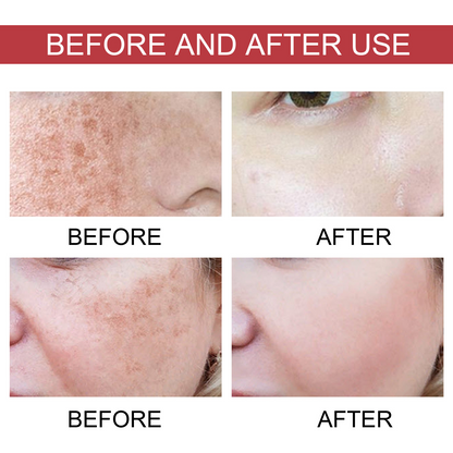 Dark Spot Serum