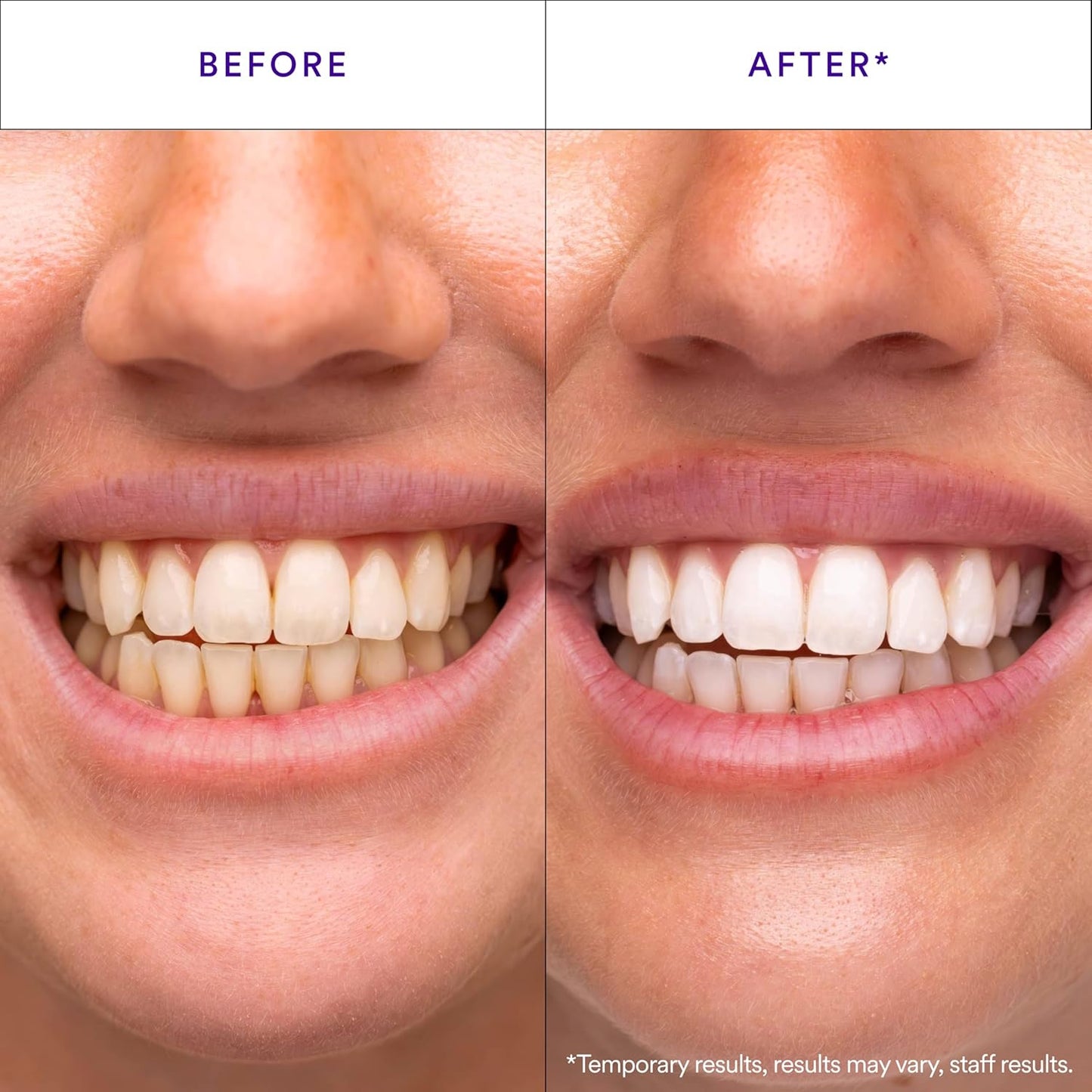 Transform Your Smile Within 30 Minutes Or Your Money Back!