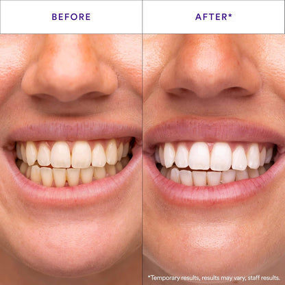 Transform Your Smile Within 30 Minutes Or Your Money Back!