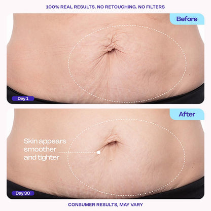Firming Body Cream - Body Firming Moisturizer for Visible Cellulite & Stretch Mark Reduction