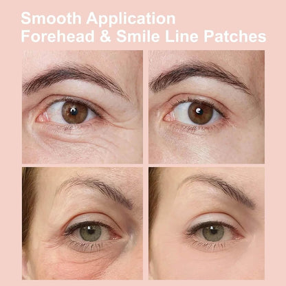Micro-Infusion Eye Patches — Depuff, Brighten & Smooth