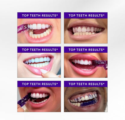 Transform Your Smile Within 30 Minutes Or Your Money Back!