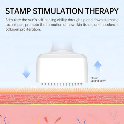 SkinVital™ Derma Stamp – Precision Microneedling Skin Tool