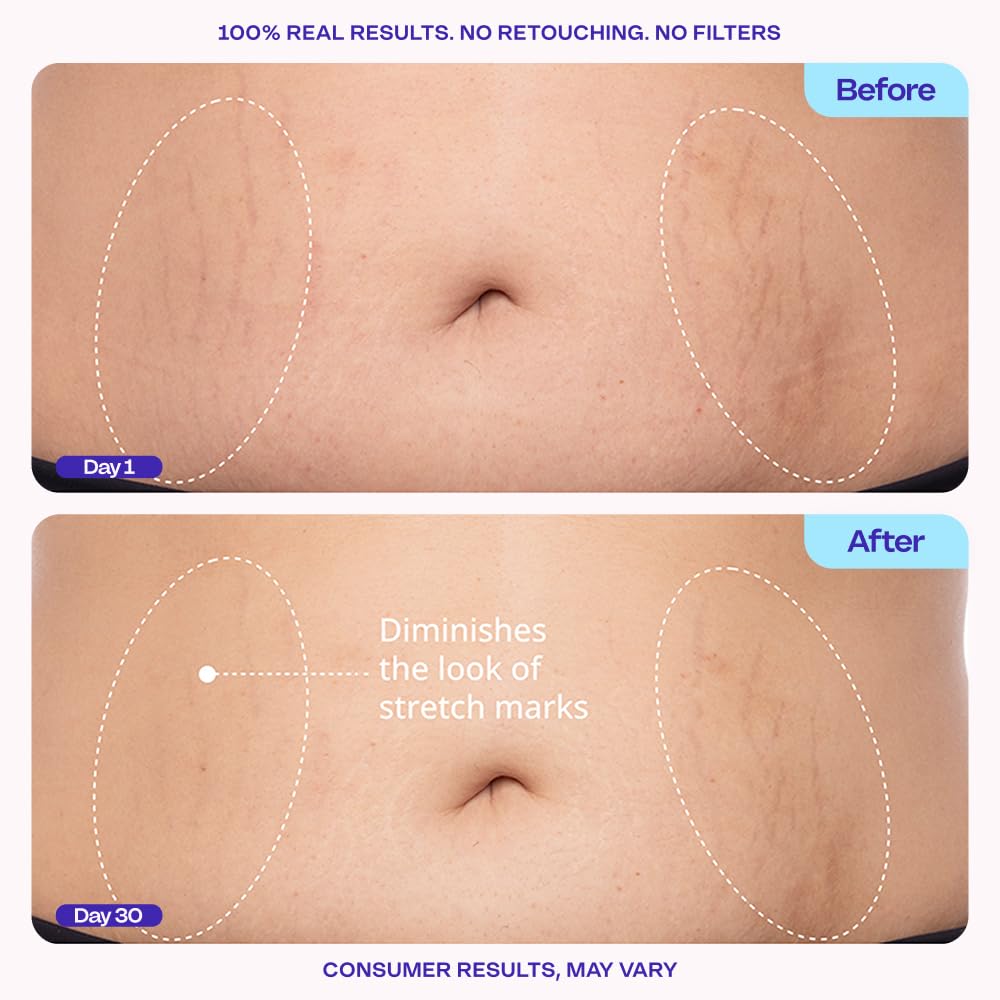 Firming Body Cream - Body Firming Moisturizer for Visible Cellulite & Stretch Mark Reduction