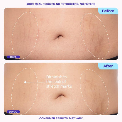 Firming Body Cream - Body Firming Moisturizer for Visible Cellulite & Stretch Mark Reduction