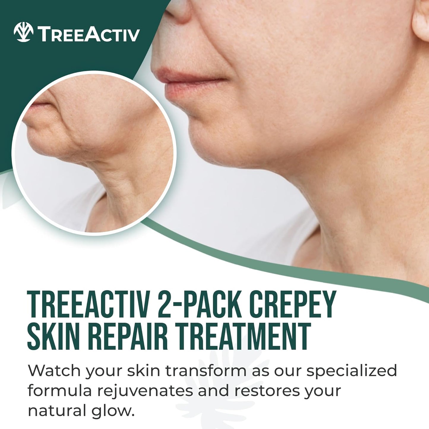 Crepey Skin Repair Treatment