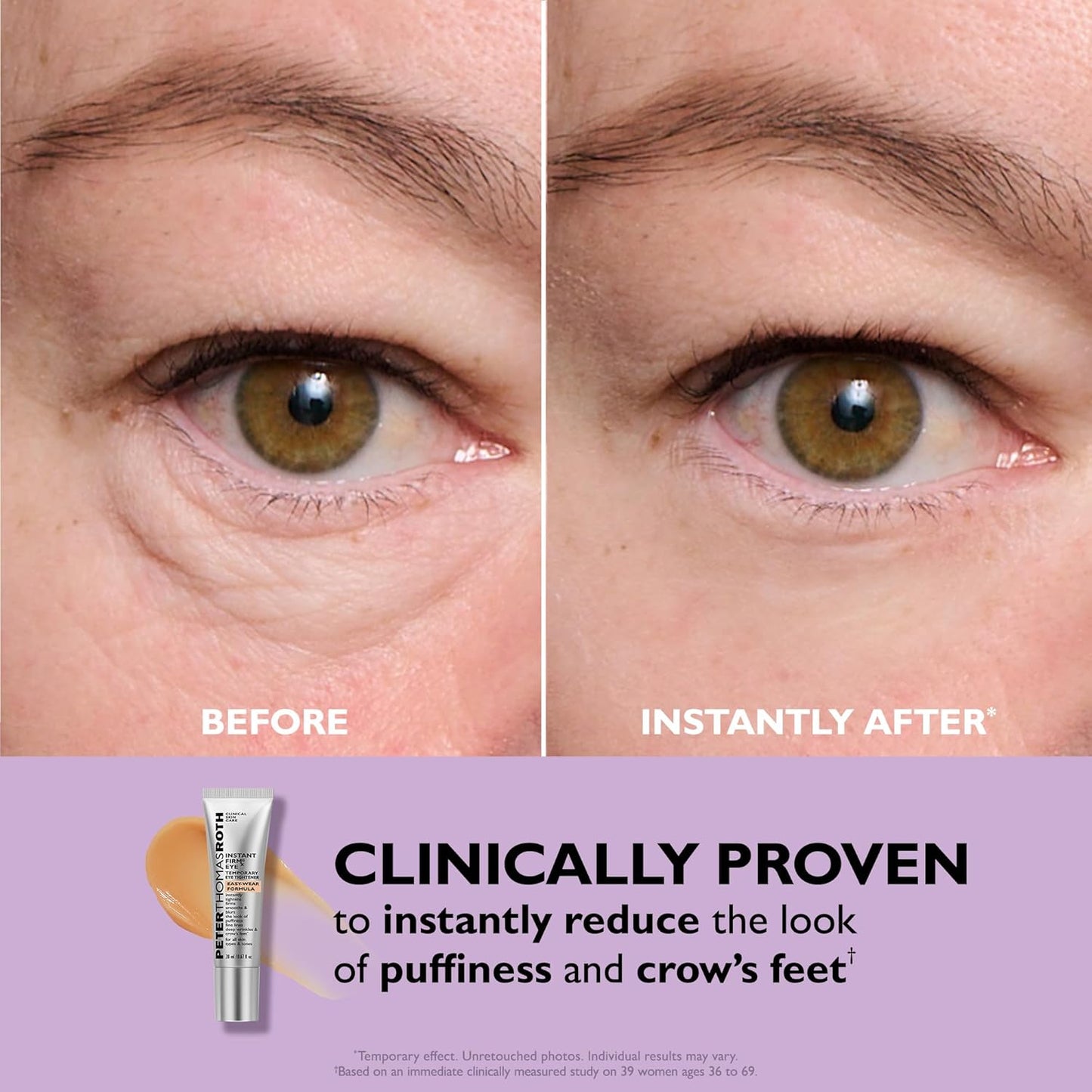 Instant FIRMx® Eye Tightener – Temporary Lift for Under-Eye Bags & Wrinkles