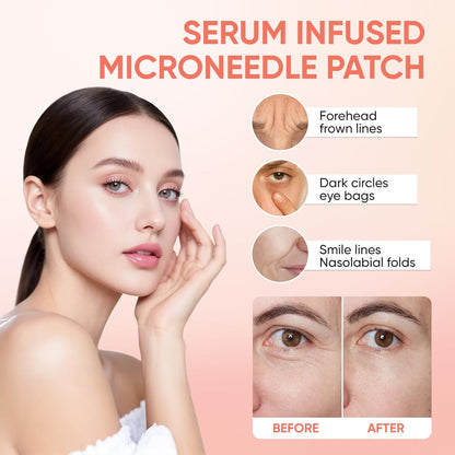 Micro-Infusion Eye Patches — Depuff, Brighten & Smooth