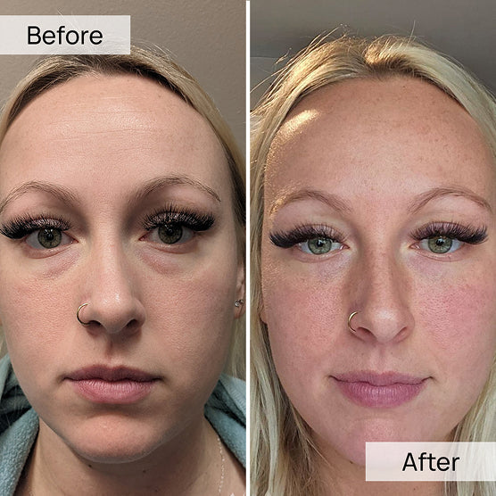 Volufiline Serum 30ml