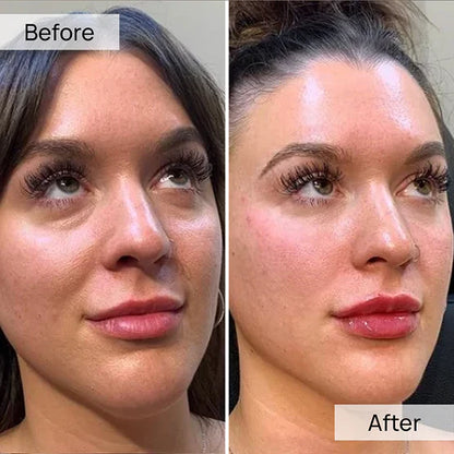 Volufiline Serum 30ml